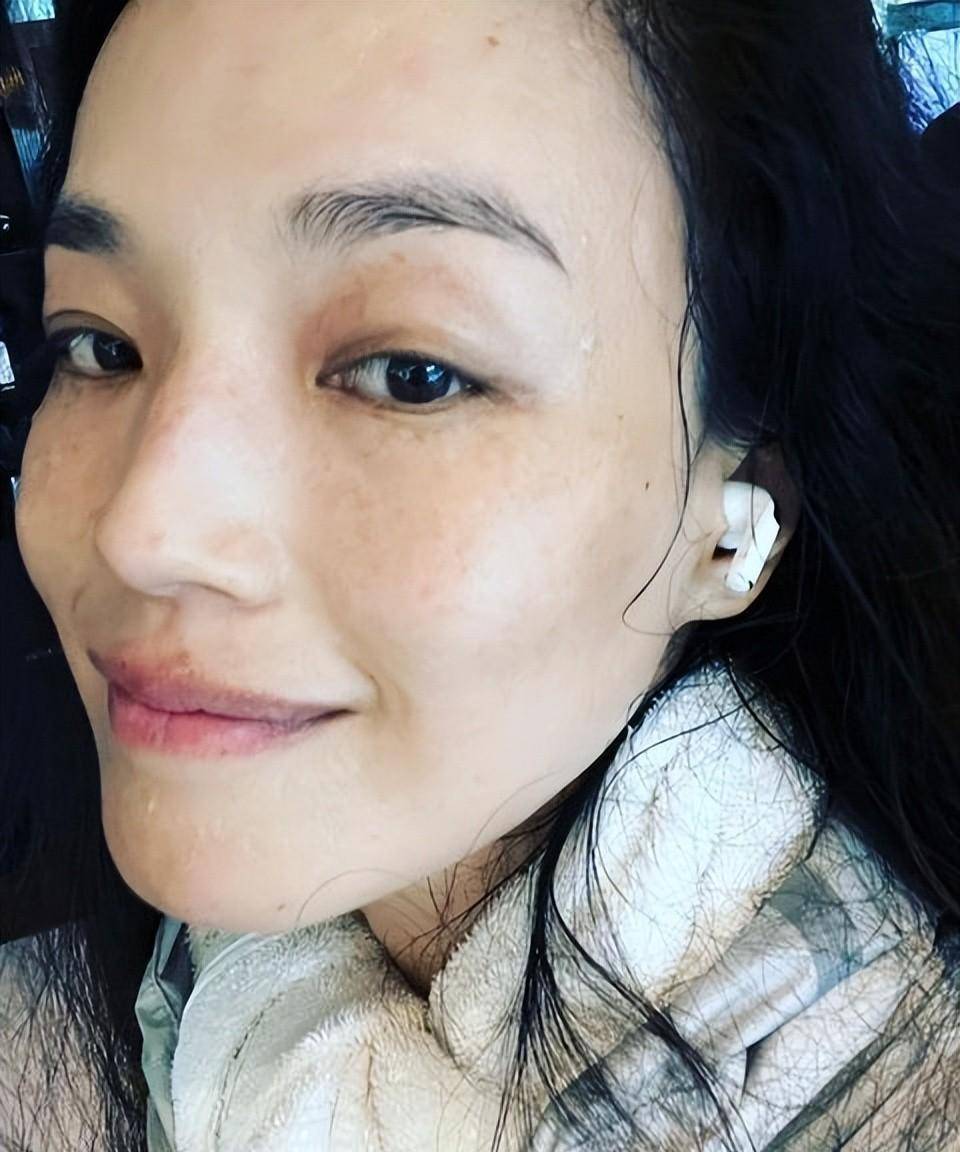 审美多元下的独特魅力，雀斑明星的自信风采
